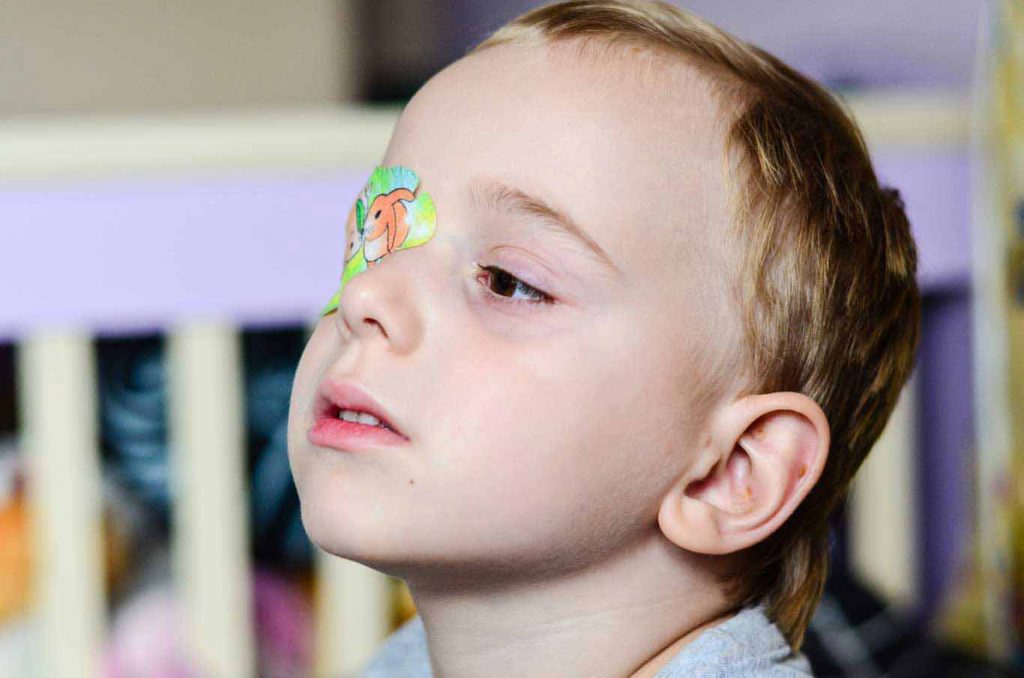 Kenali Istilah Lazy Eye Sebelum Melakukan Vision Therapy yang Tepat