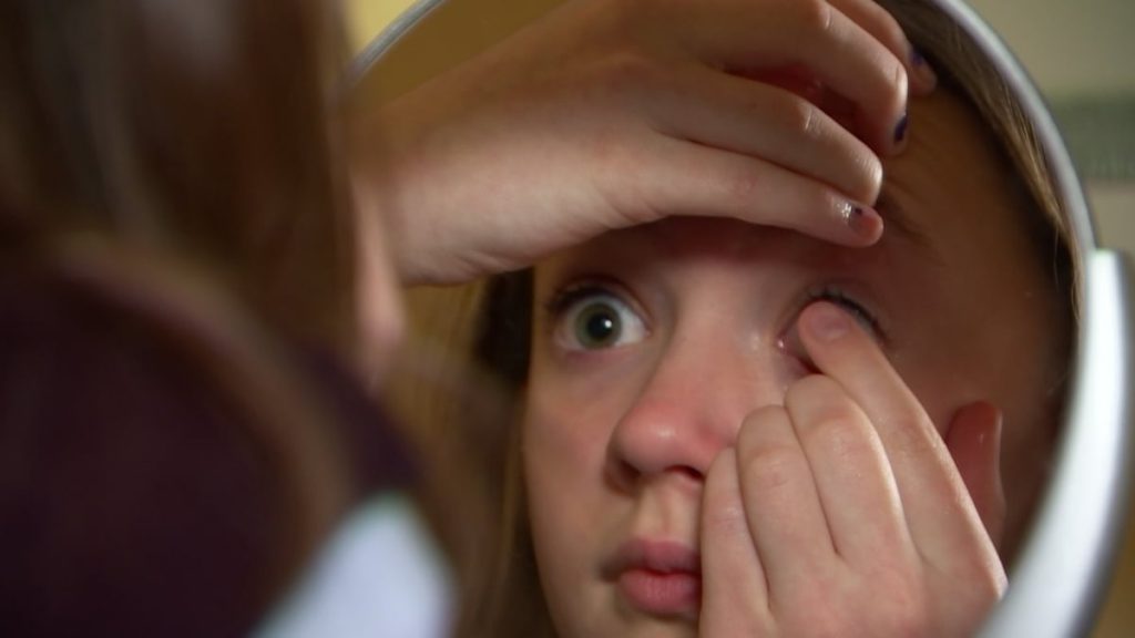 Kontrol Miopi pada Anak Anda dengan Orthokeratology