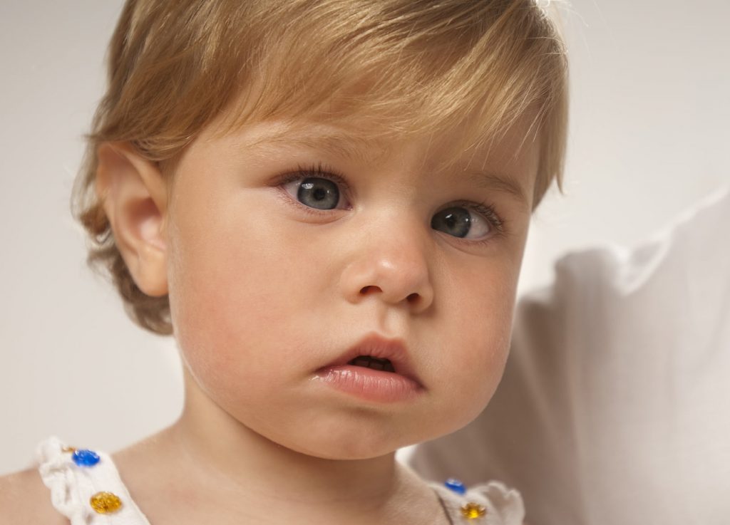 Keajaiban dari Vision Therapy untuk Kondisi Mata Strabismus
