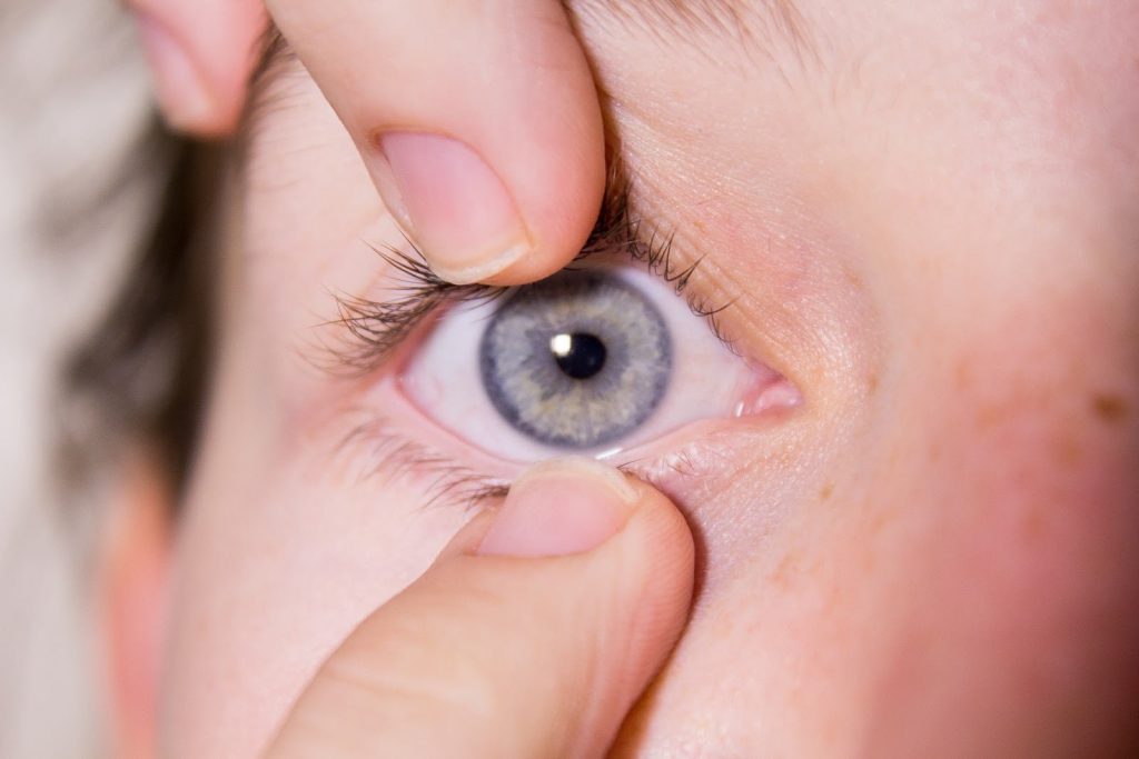 Orthokeratology Solusi Kelainan Refraksi Non Bedah Yang Efektif