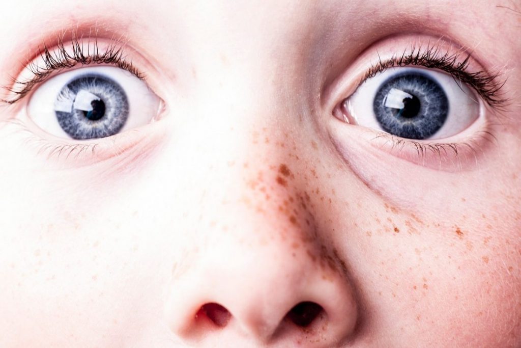 Efektivitas Orthokeratology Dalam Mengatasi Kelainan Refraksi