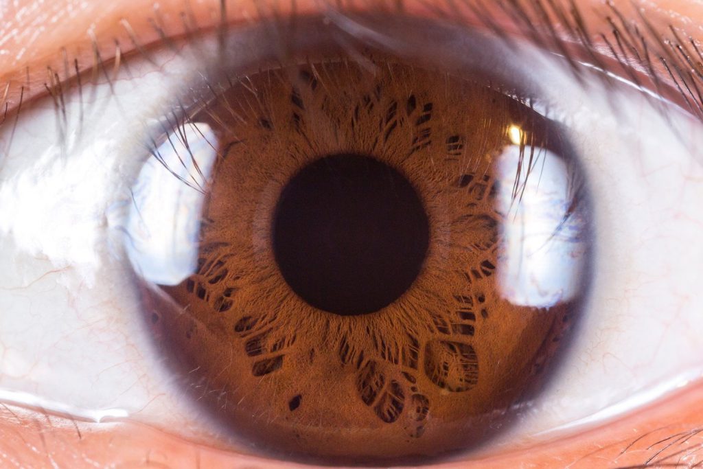 Orthokeratology, Metode Koreksi Kesalahan Refraksi yang Menjanjikan