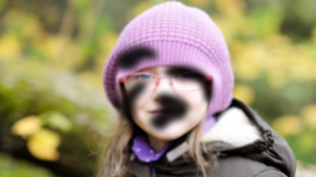 Apa itu Degenerasi Makula Terkait Usia yang Berpengaruh Pada Low Vision?
