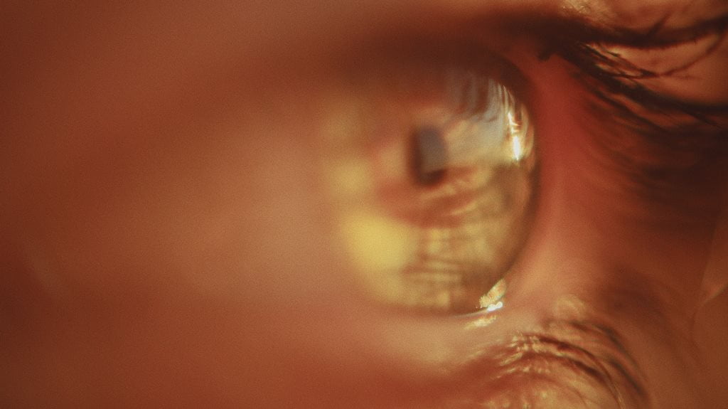 Pernahkah Anda Mendengar Tentang Orthokeratology dan Kegunaannya?