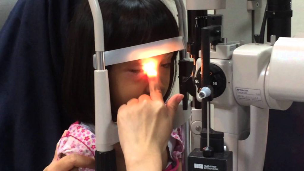 Kenapa Perlu Konsultasi Dokter Mata dan Kapan Sebaiknya Melakukannya