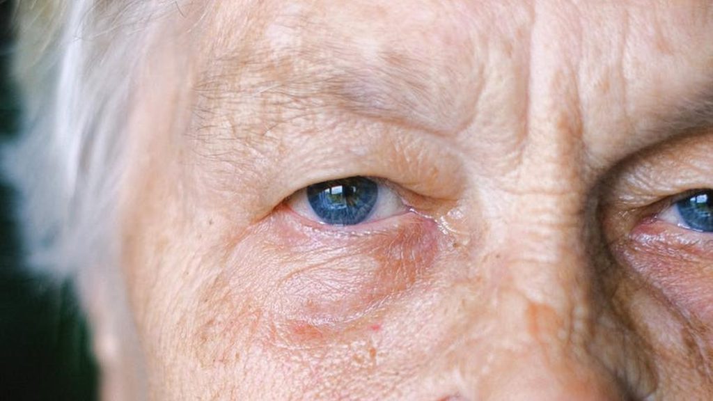 Waspadai Penyakit Degenerasi Makula yang Dapat Memicu Risiko Low Vision