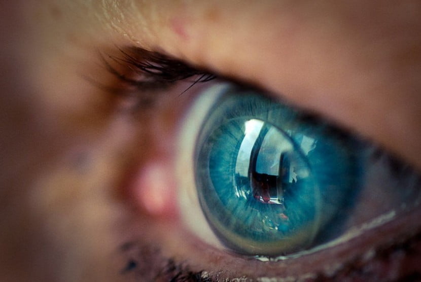 Cara Menyembuhkan Mata Minus Tanpa Operasi dengan Ortho-K (Orthokeratology)