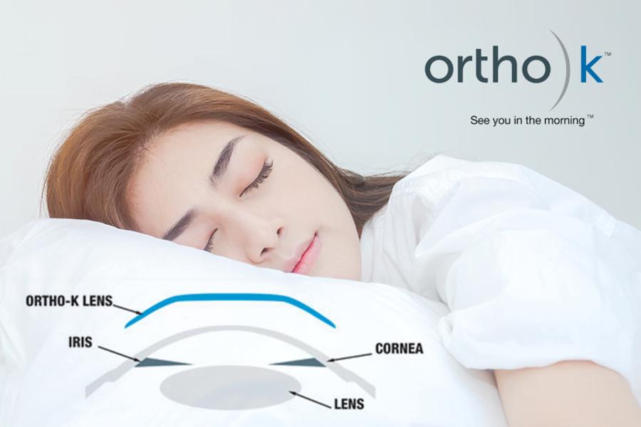 Hentikan Perkembangan Mata Minus dengan Terapi Mata Minus (Ortho-K)