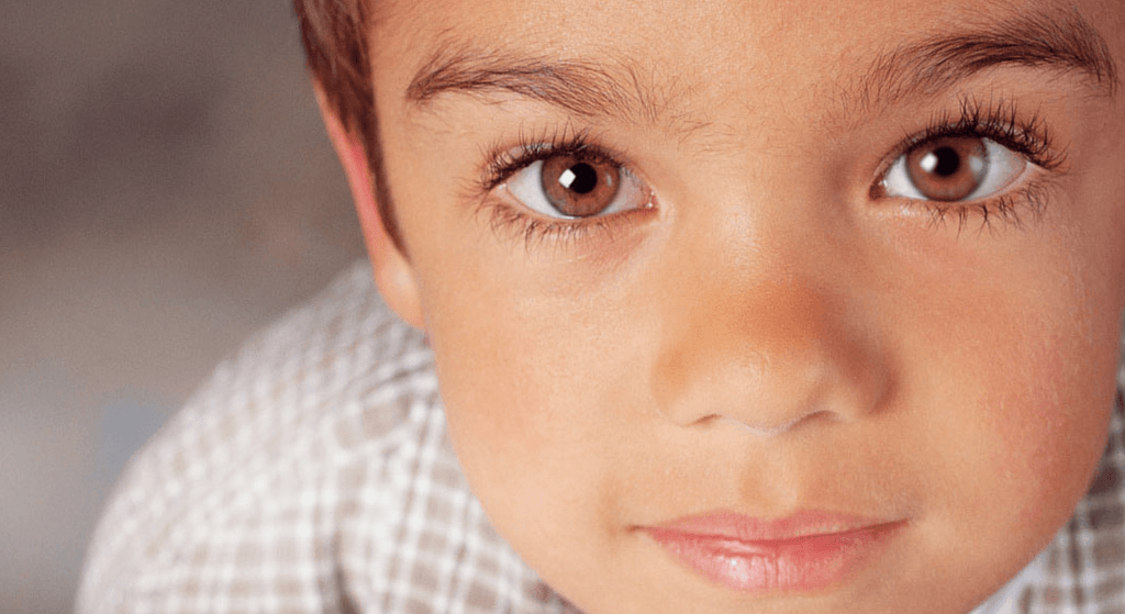 Penglihatan Bisa Terancam Karena Gangguan Mata Malas (Amblyopia)