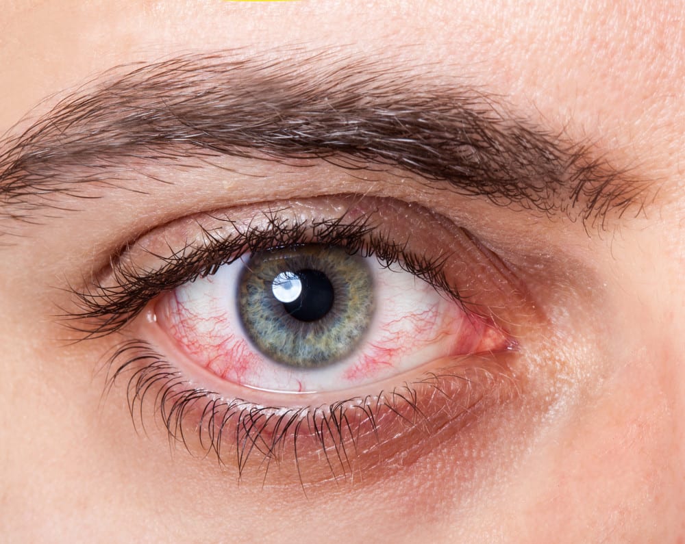 Kondisi Apa yang Dapat Diobati dengan Vision Therapy