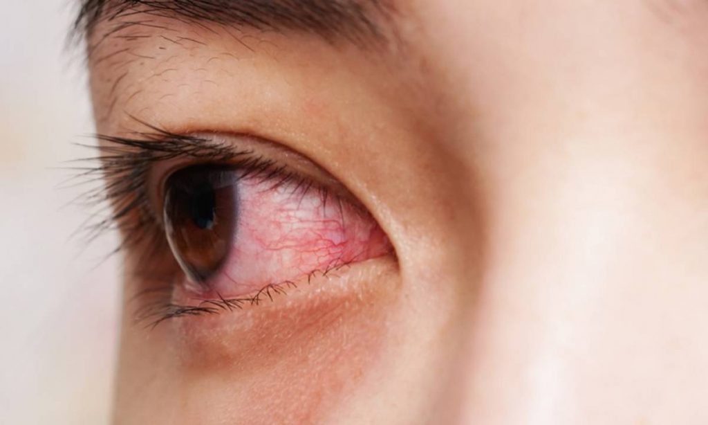 Waspadai Penyakit Retina dengan Mengenal Jenis-Jenis Gangguan pada Lapisan Mata
