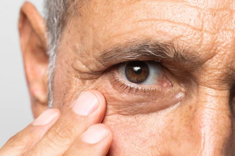 Benarkah Diabetes Bisa Sebabkan Kebutaan? Mengapa Bisa?