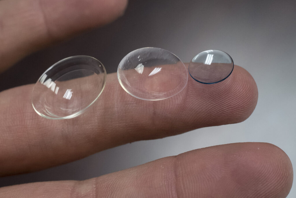 Sclera Lens: Pilihan Vision Therapy Tepat untuk Seseorang yang Mengalami Keratoconus