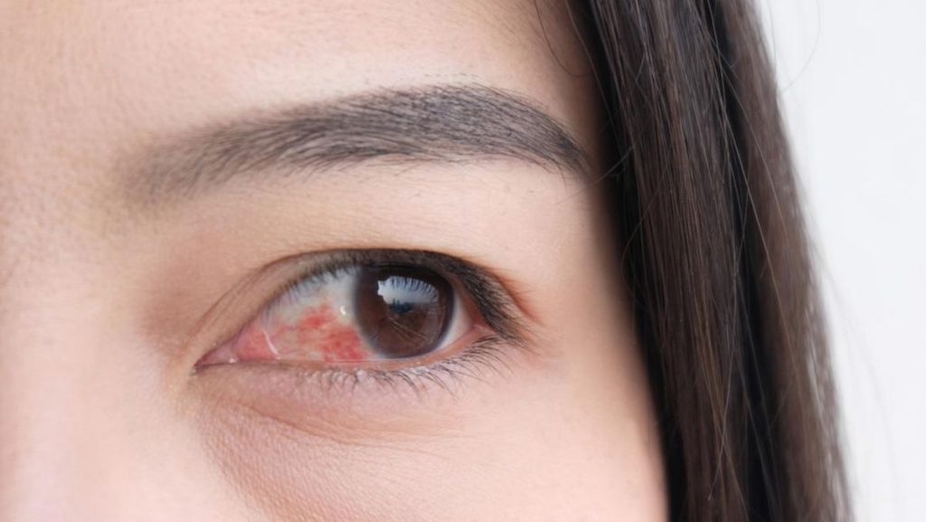 Diabetes pada Mata: Bagaimana Retinopati dan Katarak Dapat Mengubah Penglihatan Anda