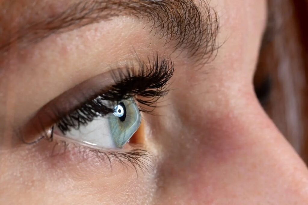 Bagaimana Penglihatan Seseorang yang Mengalami Keratoconus?