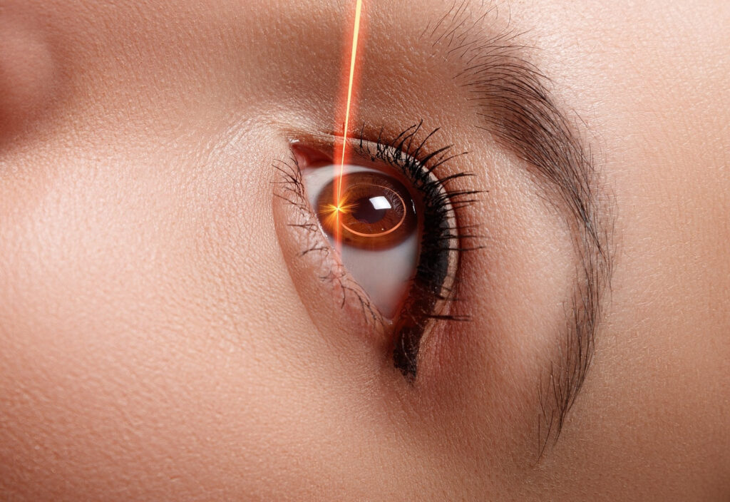 Bahaya LASIK pada Remaja: Mata Berkembang & Risiko Komplikasi Tinggi