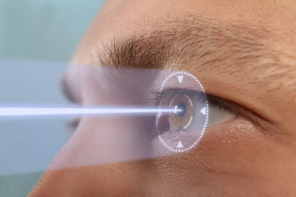 Kenapa LASIK Tidak Bisa Cocok Dijalani oleh Semua Orang?