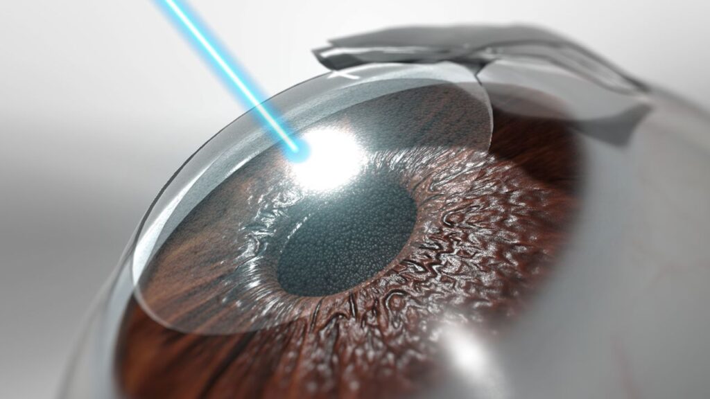 Apakah Hasil LASIK Bisa Berubah? Kenali Fakta di Balik Perubahan Penglihatan Seiring Usia