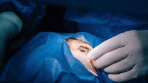 Benarkah Operasi LASIK Bisa Menyebabkan Kebutaan? Ini Fakta Medisnya