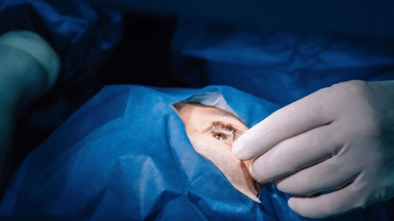 Benarkah Operasi LASIK Bisa Menyebabkan Kebutaan? Ini Fakta Medisnya