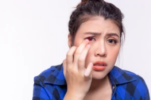 Mengenal Trikiasis, Gangguan Bulu Mata yang Tumbuh ke Arah Bola Mata